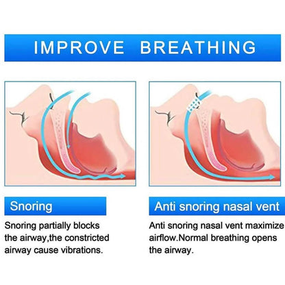 6Pcs Large anti Snoring Dilators, Snore Stopper Device Nose Vents Nasal Dilator Breathing Sleeping Relief